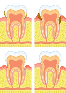 periodontal